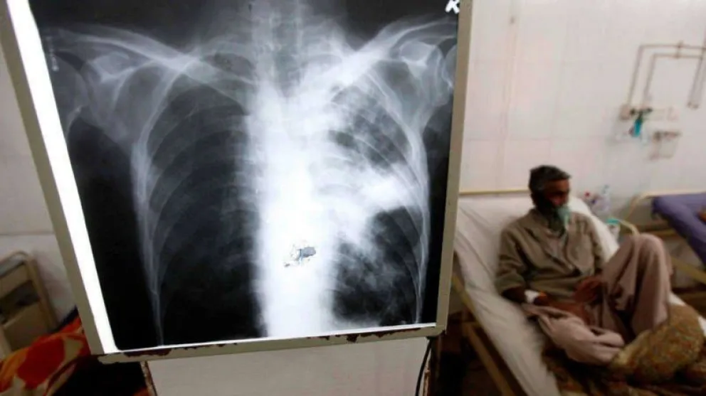 Entre Ríos, en alerta por la suba de casos de tuberculosis en 2026